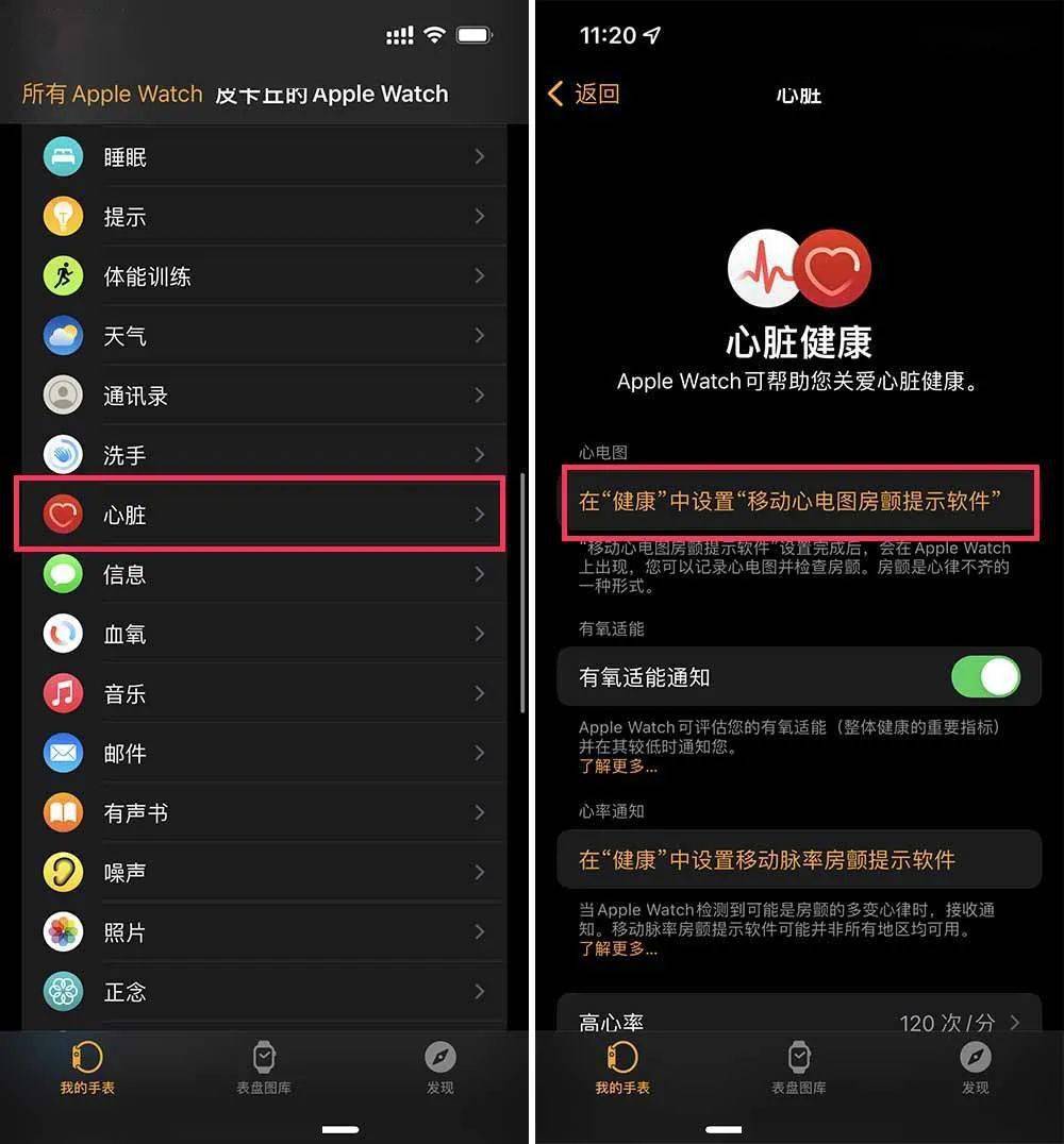 watch打开心电图_iwatch4开心电图_千万不要开启iwatch心电图