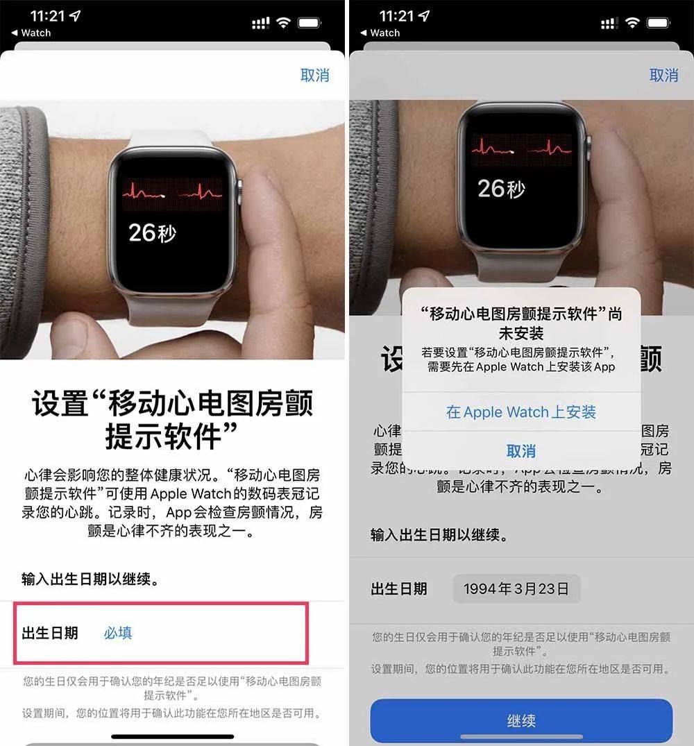 千万不要开启iwatch心电图_iwatch4开心电图_watch打开心电图