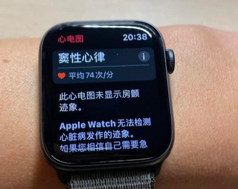 iwatch4开心电图_千万不要开启iwatch心电图_watch打开心电图