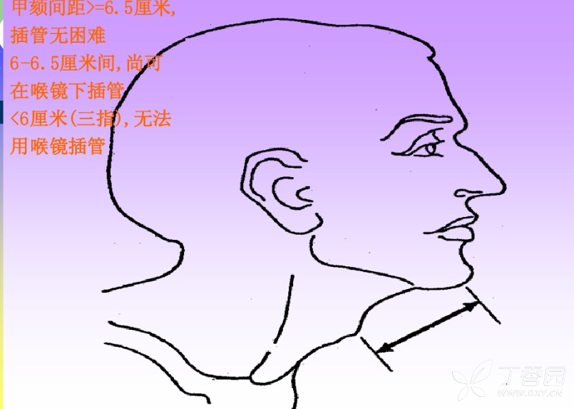 虚线画图片_cad怎么画虚线_虚线画彩色