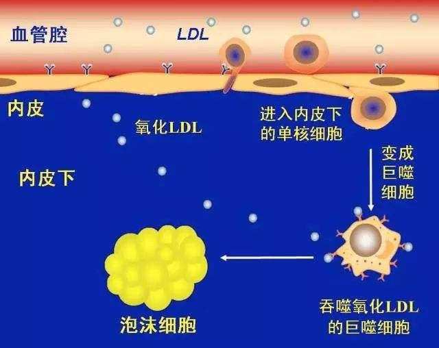 巨噬细胞的英文缩写_巨噬细胞缩写_巨噬细胞怎么写